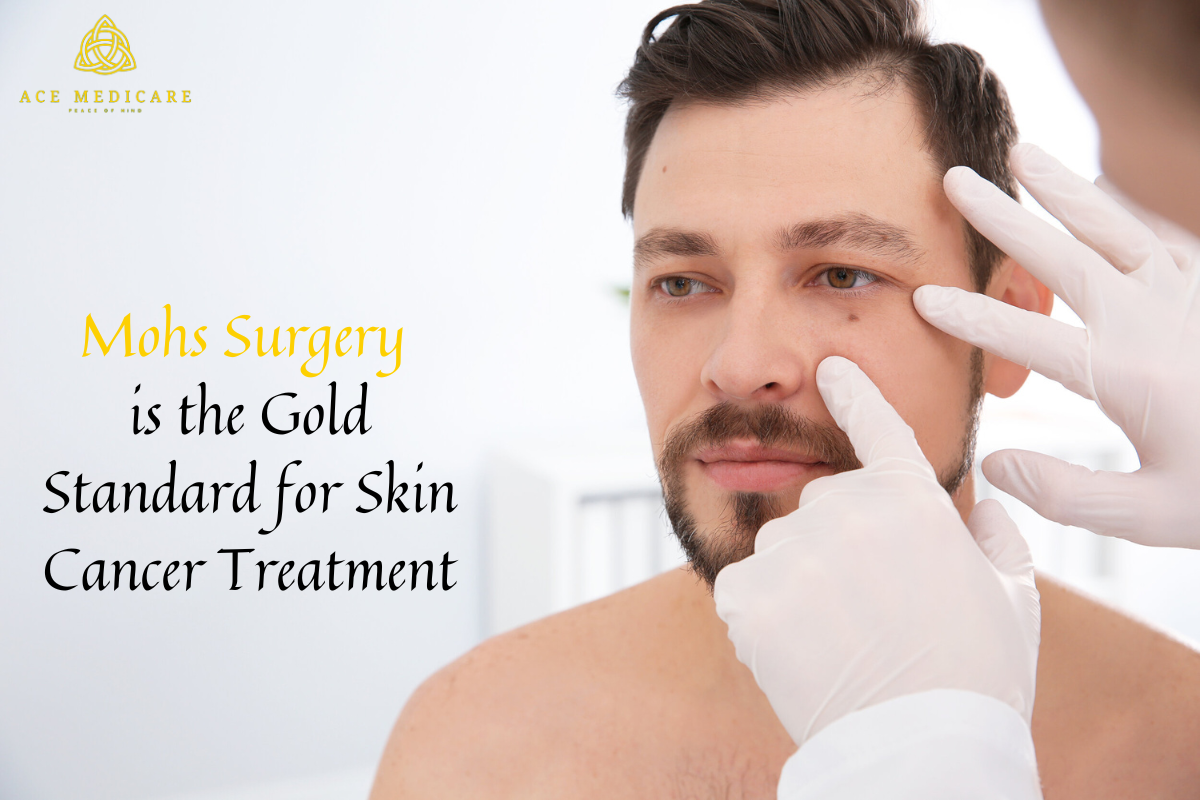 Why Mohs Surgery is the Gold Standard for Skin Cancer Treatment